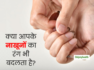 क्या आपके नाखूनों का कलर भी है लाल, पीला या काला? जानें एक्सपर्ट से इनके बदलते रंगों का कारण